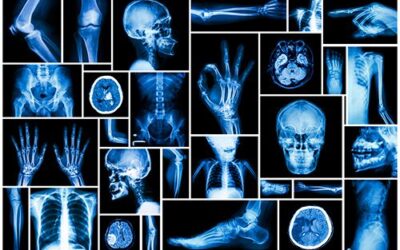 Radiologi. Loro compiti. Esclusione del compito di suggerire altri esami o richiedere consulti di altri specialisti. Non imputabilità della mancanza di approfondimento diagnostici.